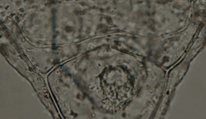 Sea Urchin Pluteus Larva