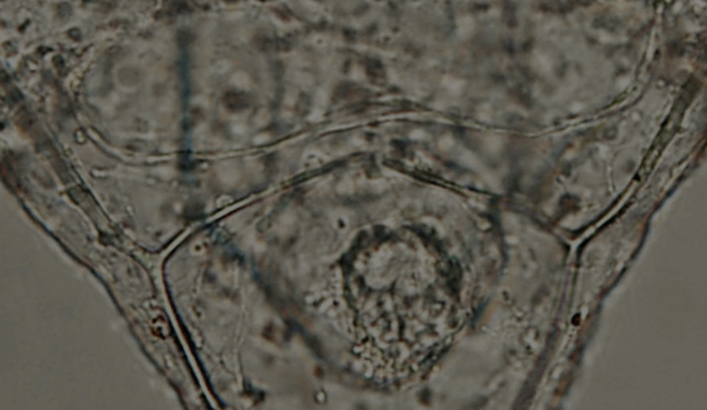 Sea Urchin Pluteus Larva